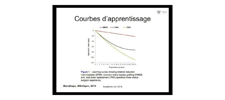 courbe d’apprentissage